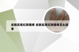 皮肤出现红斑瘙痒 皮肤出现红斑瘙痒怎么回事