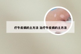 疗牛皮病的土方法 治疗牛皮病的土方法