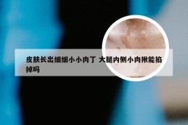 皮肤长出细细小小肉丁 大腿内侧小肉揪能掐掉吗