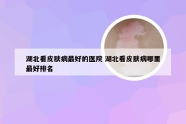 湖北看皮肤病最好的医院 湖北看皮肤病哪里最好排名