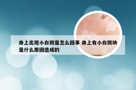 身上出现小白斑是怎么回事 身上有小白斑块是什么原因造成的