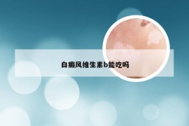 白癜风维生素b能吃吗