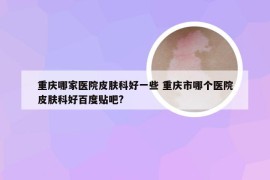 重庆哪家医院皮肤科好一些 重庆市哪个医院皮肤科好百度贴吧?