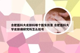 合肥医科大皮肤科哪个医生厉害 合肥医科大学皮肤病研究所怎么挂号