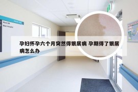 孕妇怀孕六个月突然得银屑病 孕期得了银屑病怎么办