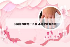 小腿部白斑是什么病 小腿皮肤有白斑