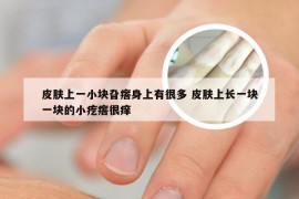 皮肤上一小块旮瘩身上有很多 皮肤上长一块一块的小疙瘩很痒