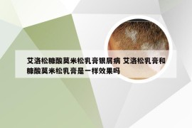艾洛松糠酸莫米松乳膏银屑病 艾洛松乳膏和糠酸莫米松乳膏是一样效果吗
