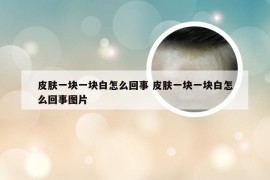 皮肤一块一块白怎么回事 皮肤一块一块白怎么回事图片