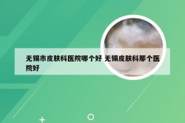 无锡市皮肤科医院哪个好 无锡皮肤科那个医院好