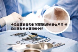 卡泊三醇软膏和他克莫司软膏有什么不同 卡泊三醇和他克莫司哪个好