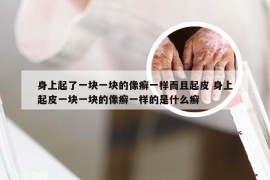 身上起了一块一块的像癣一样而且起皮 身上起皮一块一块的像癣一样的是什么癣