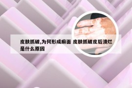 皮肤抓破,为何形成癣面 皮肤抓破皮后溃烂是什么原因