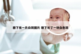 腋下有一片白斑图片 腋下长了一块白色斑