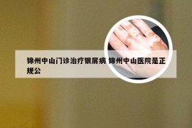 锦州中山门诊治疗银屑病 锦州中山医院是正规公