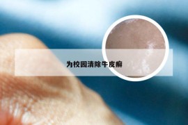 为校园清除牛皮癣