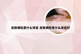 皮肤病检查什么项目 皮肤病检查什么项目好