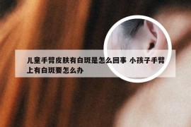 儿童手臂皮肤有白斑是怎么回事 小孩子手臂上有白斑要怎么办