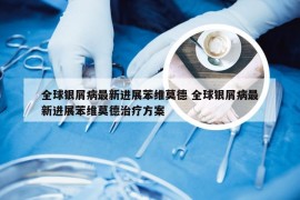 全球银屑病最新进展苯维莫德 全球银屑病最新进展苯维莫德治疗方案