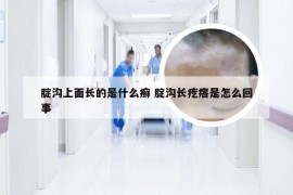 腚沟上面长的是什么癣 腚沟长疙瘩是怎么回事