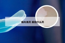 癣内用药 癣放什么药