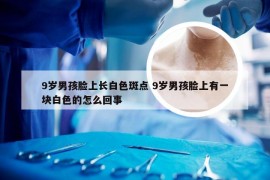 9岁男孩脸上长白色斑点 9岁男孩脸上有一块白色的怎么回事