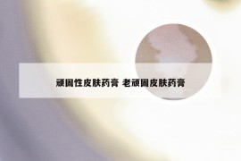 顽固性皮肤药膏 老顽固皮肤药膏