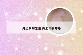 身上长癣怎治 身上长癣咋办