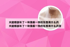 大腿根部长了一块像癣一样的东西用什么药 大腿根部长了一块像癣一样的东西用什么药膏