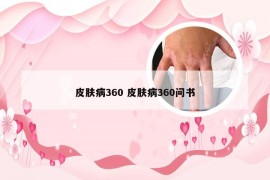 皮肤病360 皮肤病360问书