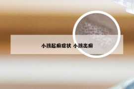 小孩起癣症状 小孩出癣
