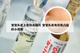 宝宝头皮上有白点图片 宝宝头皮有白色凸起的小疙瘩