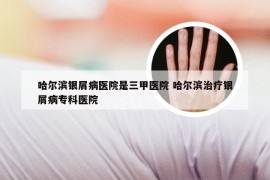 哈尔滨银屑病医院是三甲医院 哈尔滨治疗银屑病专科医院