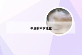 牛皮癣六岁儿童