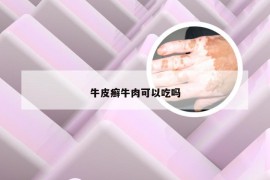 牛皮癣牛肉可以吃吗