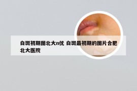 白斑初期图北大n优 白斑最初期的图片合肥北大医院