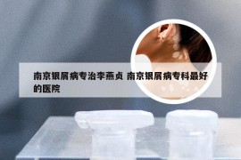 南京银屑病专治李燕贞 南京银屑病专科最好的医院