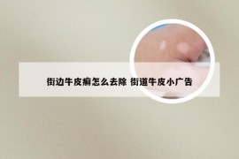 街边牛皮癣怎么去除 街道牛皮小广告