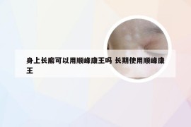 身上长廨可以用顺峰康王吗 长期使用顺峰康王