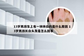 13岁男孩生上有一块块白的是什么原因 13岁男孩长白头发是怎么回事
