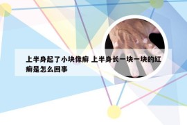 上半身起了小块像癣 上半身长一块一块的红癣是怎么回事