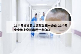 22个月宝宝脸上突然出现一条白 22个月宝宝脸上突然出现一条白块