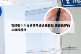 宿迁哪个牛皮癣医院好选择楚街 宿迁最好的皮肤科医院