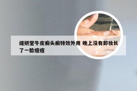 缇妍堂牛皮癣头癣特效外用 晚上没有卸妆长了一脸痘痘