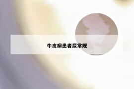 牛皮癣患者尿常规