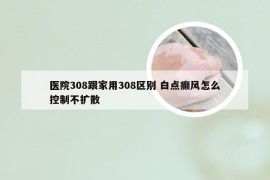 医院308跟家用308区别 白点癫风怎么控制不扩散