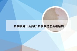 白病疯用什么药好 白疯病是怎么引起的