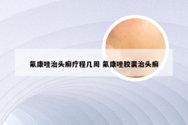 氟康唑治头癣疗程几周 氟康唑胶囊治头癣