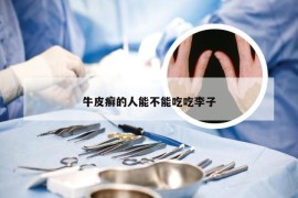 牛皮癣的人能不能吃吃李子