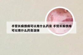 手臂长癣很痒可以用什么药膏 手臂长癣很痒可以用什么药膏涂抹